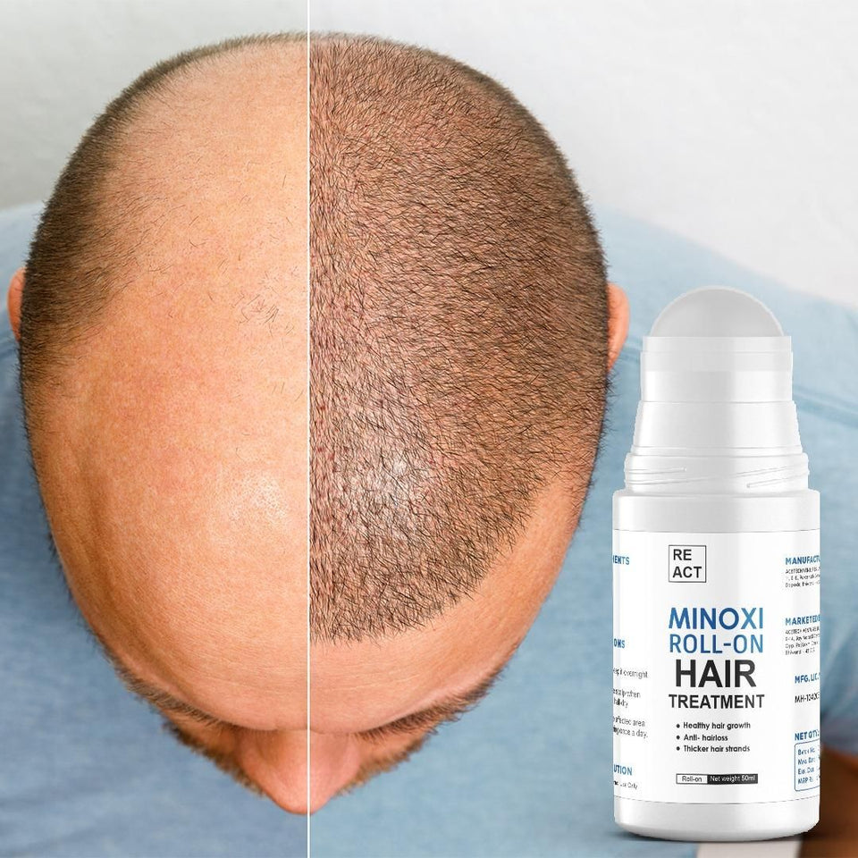Minoxi Roll-On Hair Growth Serum