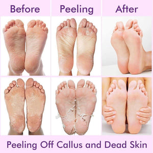 Exfoliating Foot Mask Hydrating Sock