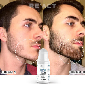 Minoxi Roll-On Hair Growth Serum
