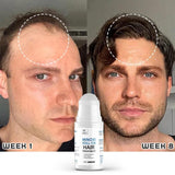 Minoxi Roll-On Hair Growth Serum